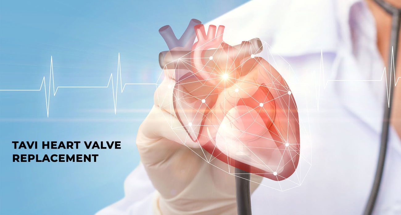 TAVI & TAVR Heart Valve Replacement Procedure