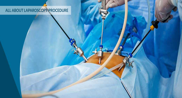 Everything You Must Know About Laparoscopic and General Surgeries