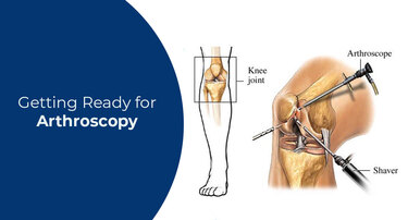 Getting Ready for Arthroscopy