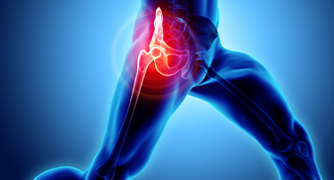 What to expect from a Hip Replacement Surgery?