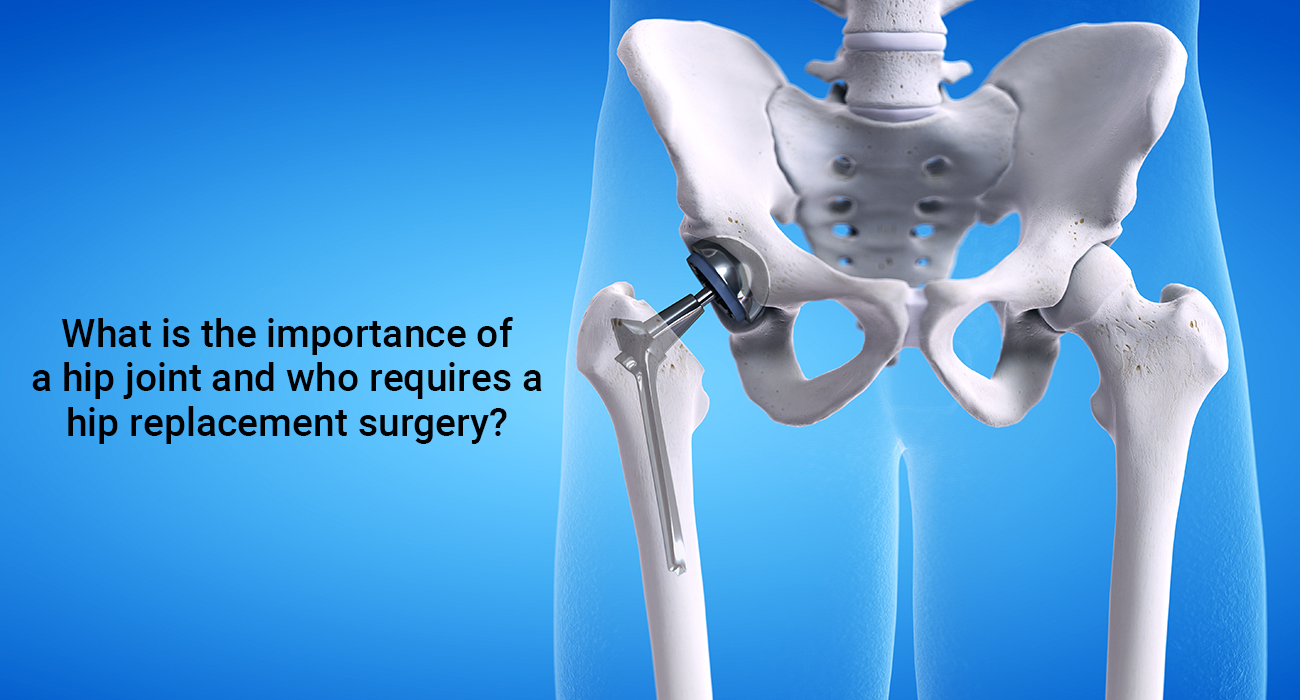 What is the importance of a Hip Joint and who requires Hip Replacement Surgery?