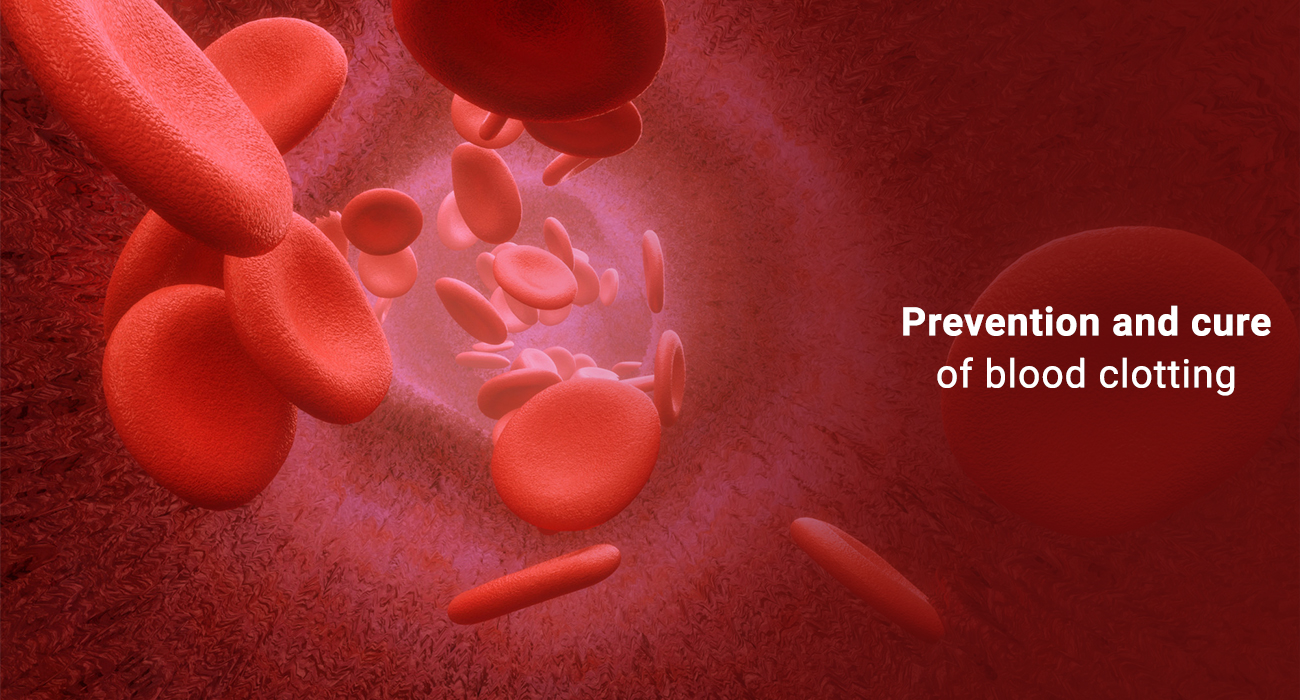 Symptoms, Prevention, and cure of Blood Clotting