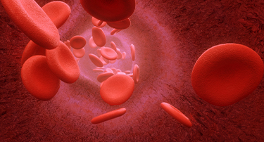 Symptoms, Prevention, and cure of Blood Clotting