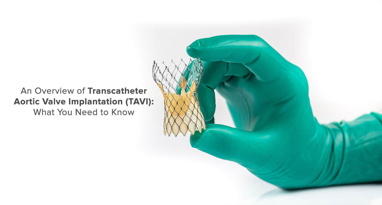 An Overview of Transcatheter Aortic Valve Implantation TAVI: What You Need to Know
