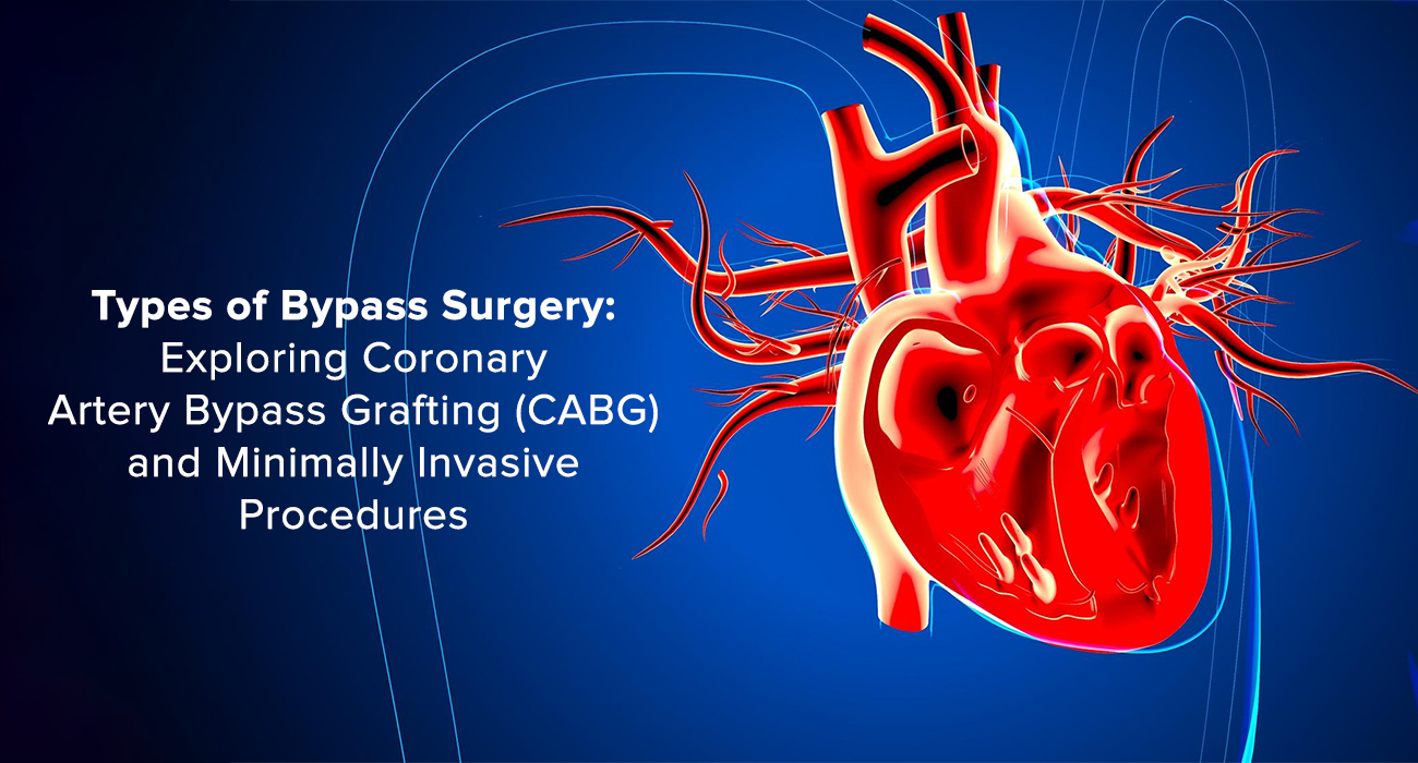Types of Bypass Surgery: Exploring Coronary Artery Bypass Grafting (CABG) and Minimally Invasive Procedures
