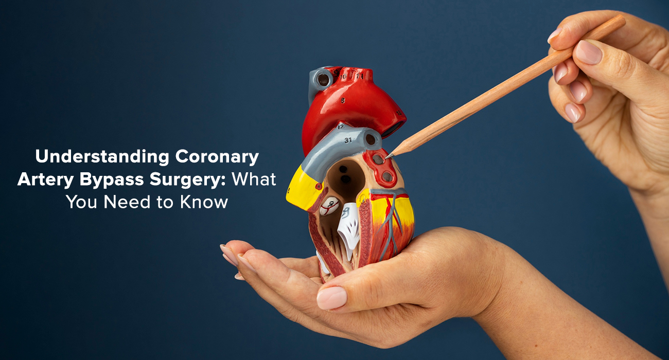 Understanding Coronary Artery Bypass Surgery: What You Need to Know