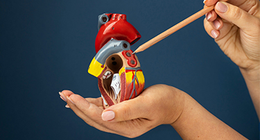 Understanding Coronary Artery Bypass Surgery: What You Need to Know