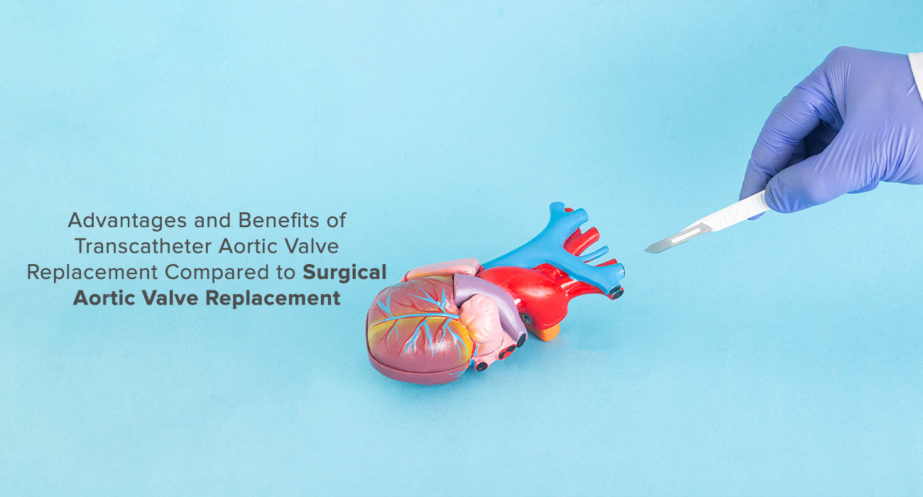 Advantages and Benefits of Transcatheter Aortic Valve Replacement Compared to Surgical Aortic Valve Replacement