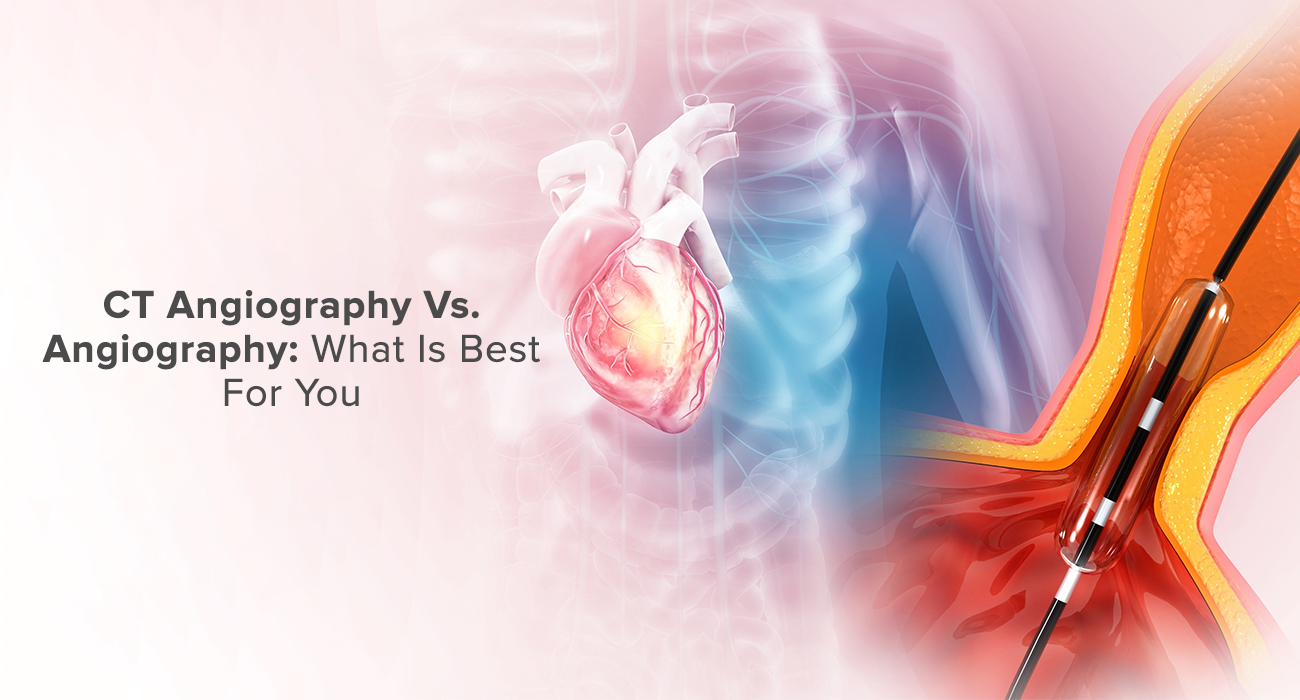CT Angiography Vs. Angiography: What Is Best For You?