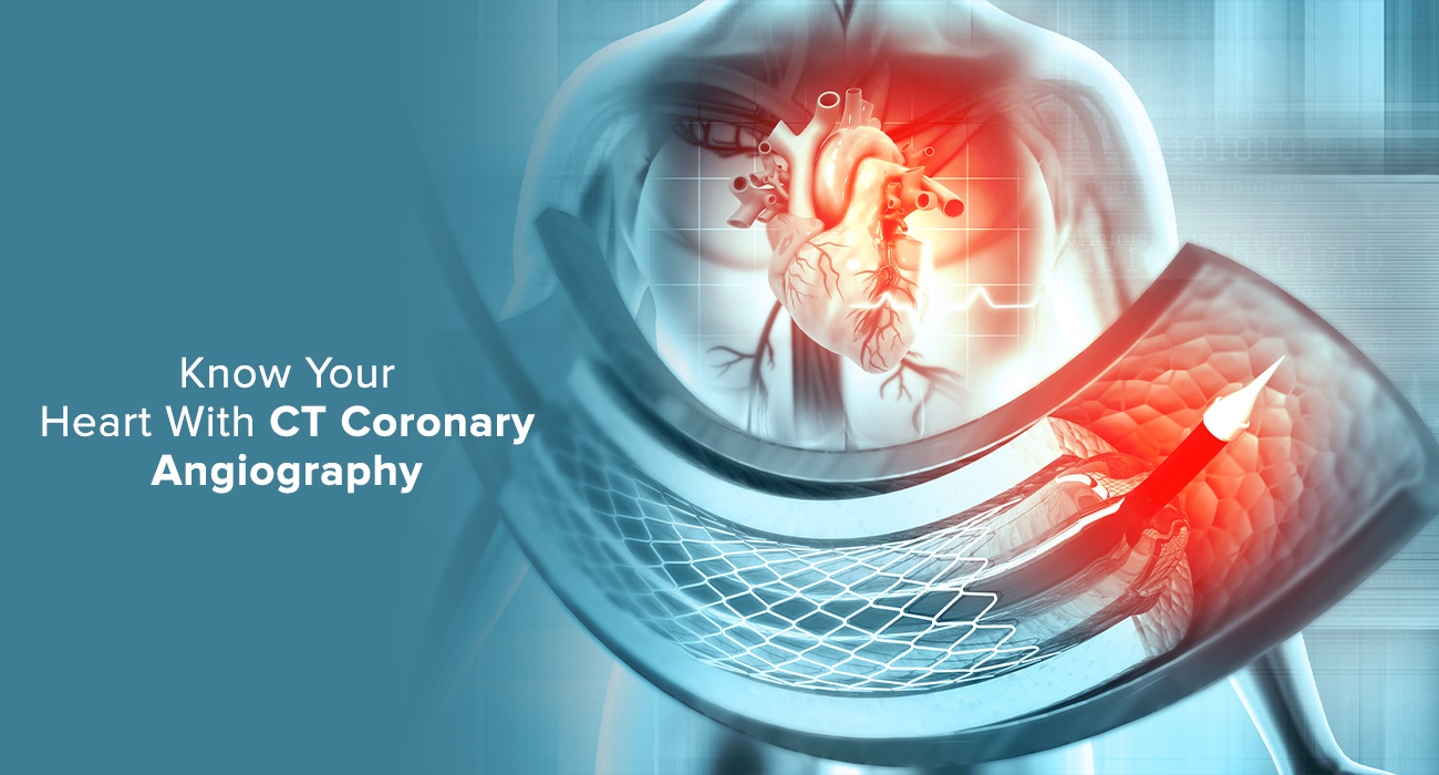 Know Your Heart With CT Coronary Angiography