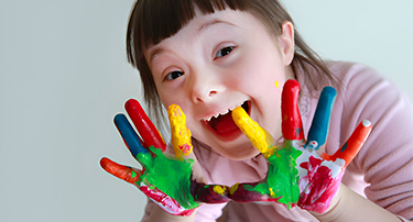 Down Syndrome: Symptoms, Causes, Diagnosis And Treatment