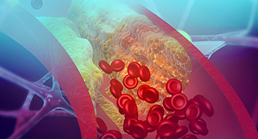 Understanding Cardiovascular Disease: Key Risks And Root Causes