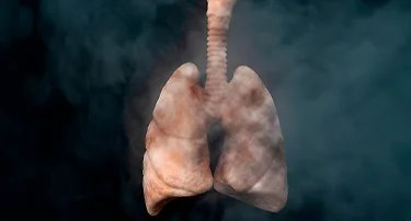 The Impact of Air Pollution on Lung Health: Protective Measures and Tips