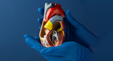 Life After Heart Transplantation: Health And Lifestyle Changes