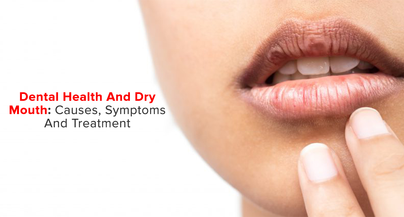 Dental Health and Dry Mouth: Causes, Symptoms and Treatment
