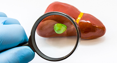 Gallbladder Disease - Causes, Symptoms and Treatment Options
