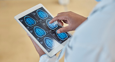 What Happens During Brain Surgery? A Step-by-Step Breakdown