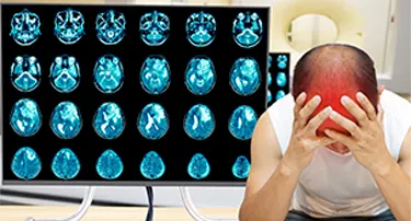 Understanding Brain Tumor Symptoms and Treatment Options