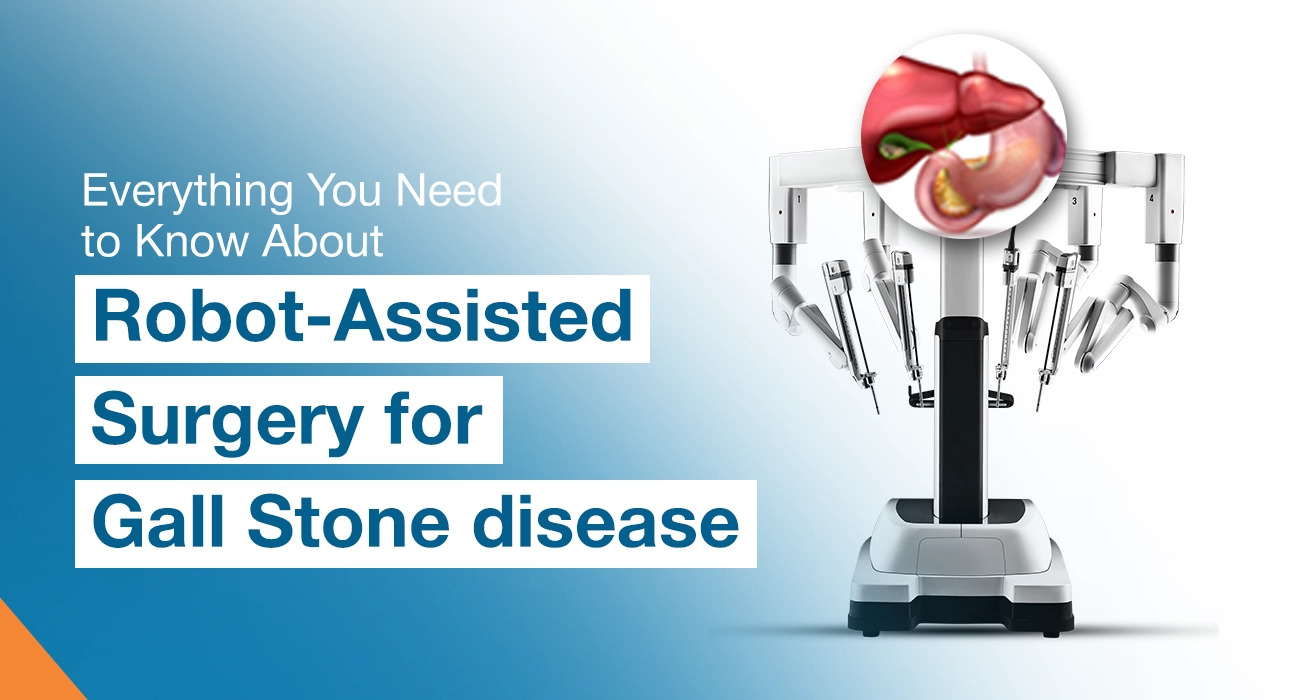 Everything You Need to Know About Robot-Assisted Surgery for Gall Stone Disease