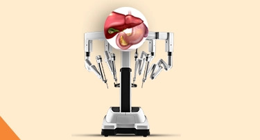 Everything You Need to Know About Robot-Assisted Surgery for Gall Stone Disease