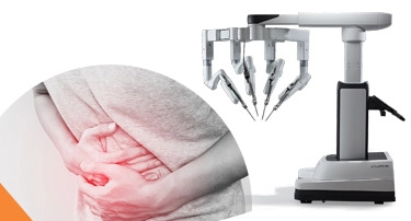 Robotic Hernia Repair: Faster Recovery, Less Pain & Better Outcomes