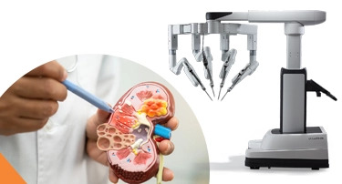 How Is Robotic Partial Nephrectomy Changing Kidney Tumor Treatment?