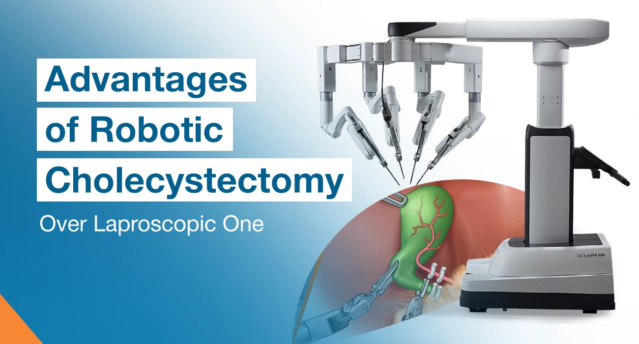 Advantages of Robotic Cholecystectomy Over Laparoscopic One