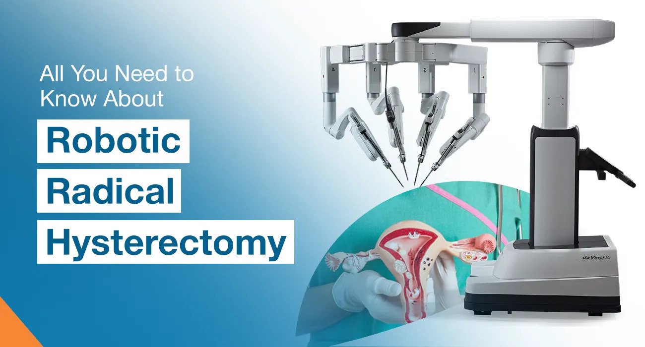 All You Need to Know About Robotic Radical Hysterectomy