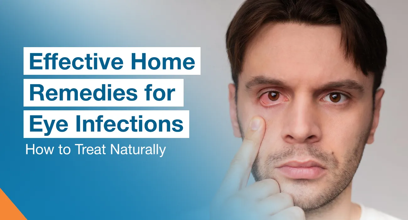 Effective Home Remedies for Eye Infections: How to Treat Naturally