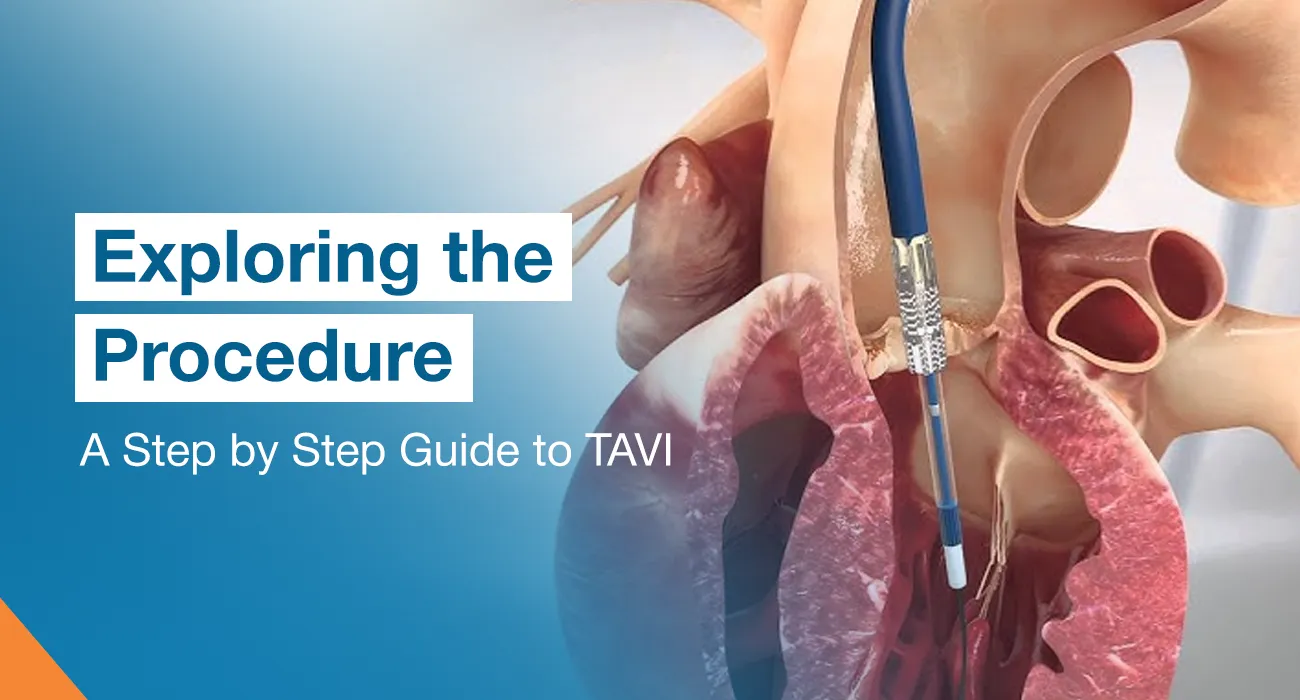Exploring the Procedure: A Step by Step Guide to TAVI