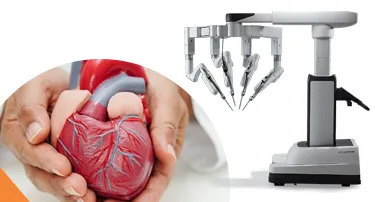 Robotic Heart Surgery in India: Benefits of da Vinci Xi for Complex Cardiac Conditions