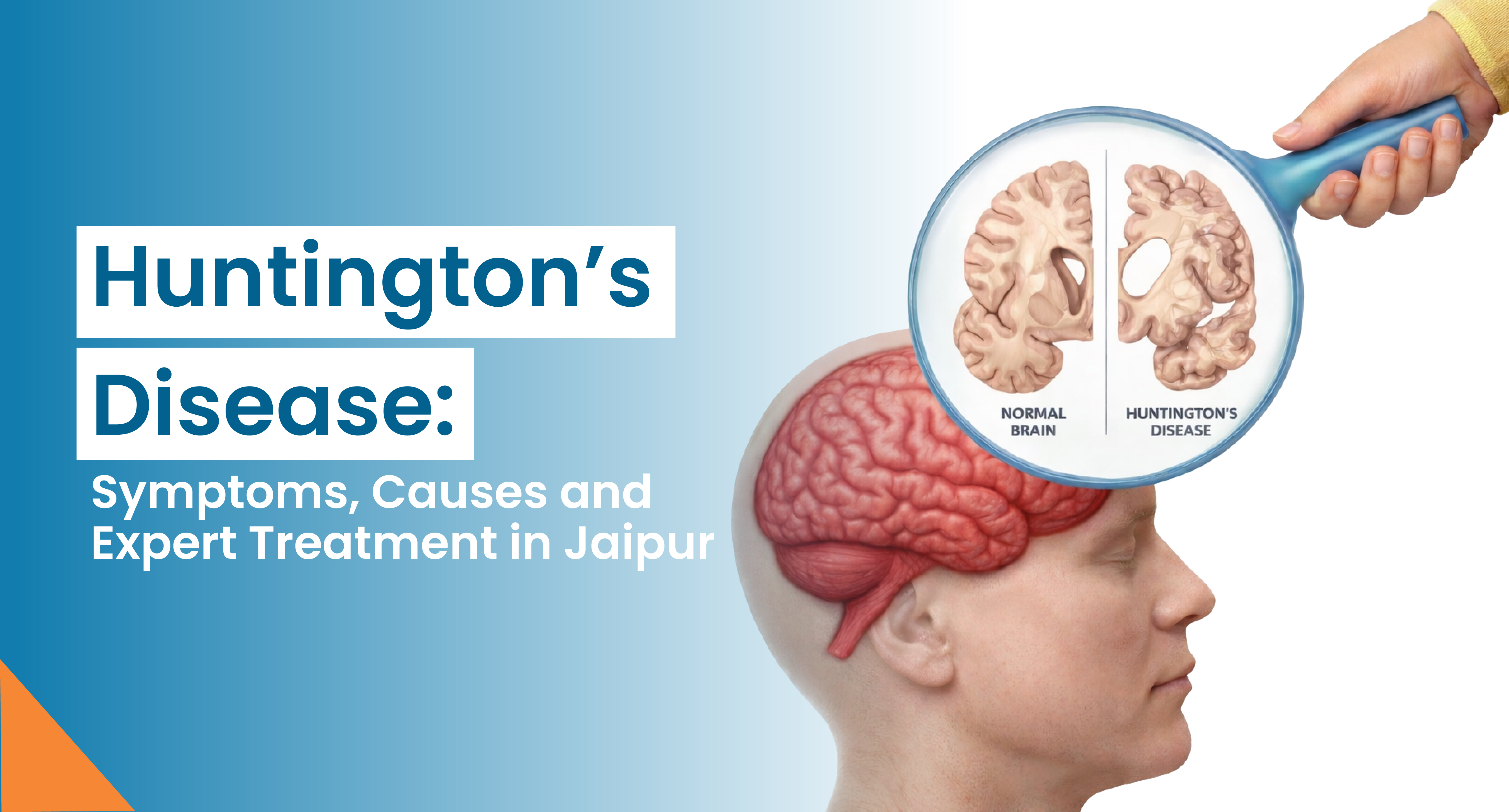 Huntington’s Disease: Symptoms, Causes, and Expert Treatment in Jaipur