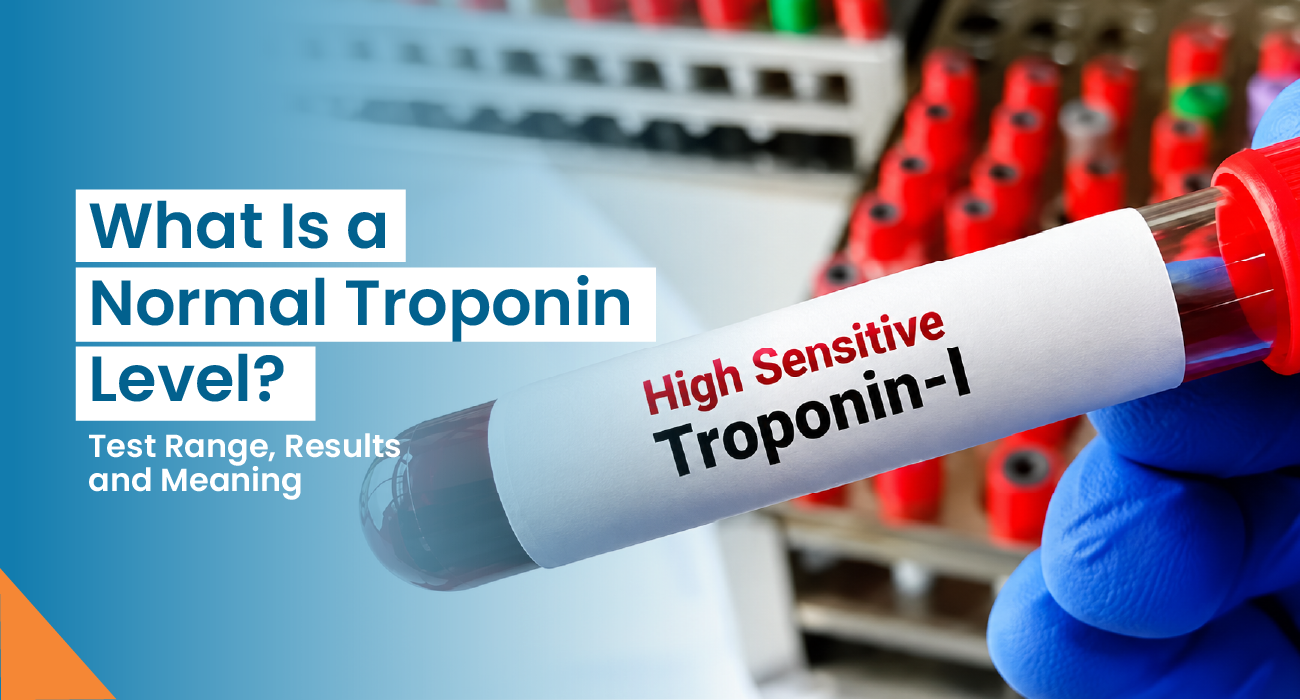 What Is a Normal Troponin Level? Test Range, Results & Meaning