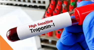 <p>A normal troponin level is generally very low or undetectable in healthy people. However, there is no single normal value that applies to every troponin test.</p>
