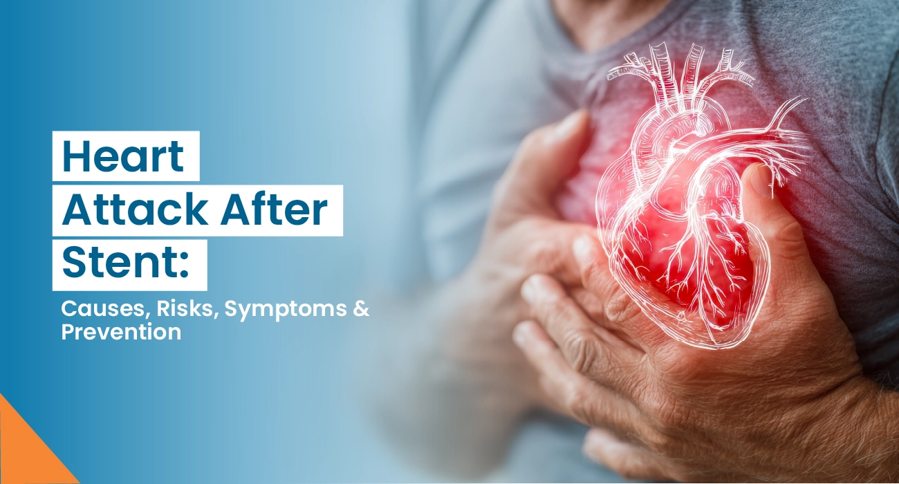 Heart Attack After Stent: Causes, Risks, Symptoms & Prevention