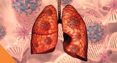 <p>World Pneumonia Day 2026, which is a global initiative observed on 12 November annually.</p>
